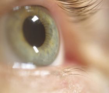 Eye, Eyelid Problems in Wahiawa, HI