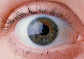Eye, Red Eyes in Wahiawa, HI